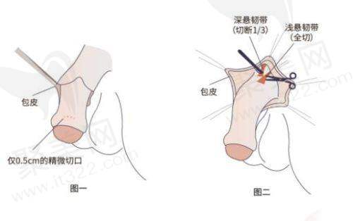 24小时留院观察的独特优势