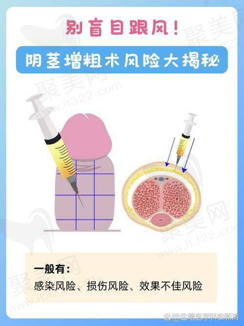 总结：男科增粗手术住院及修复要点回顾