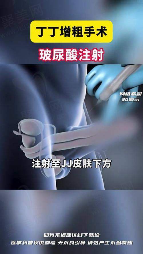 术后多维度管理具体措施解析