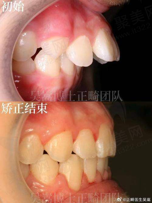 二、北京劲松口腔——北京牙齿矫正医院排名前十的人气之选