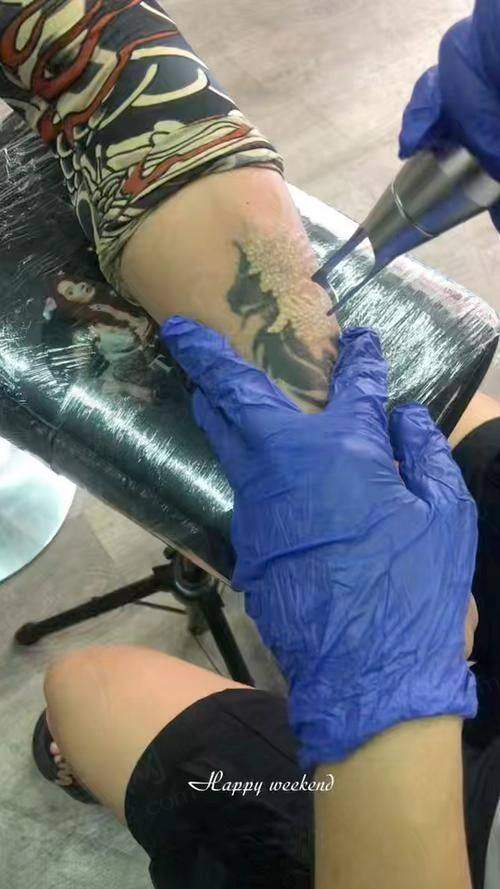 成都素美医疗美容皮秒激光去纹身原价4000元，现260元起开启纹身清除新体验！