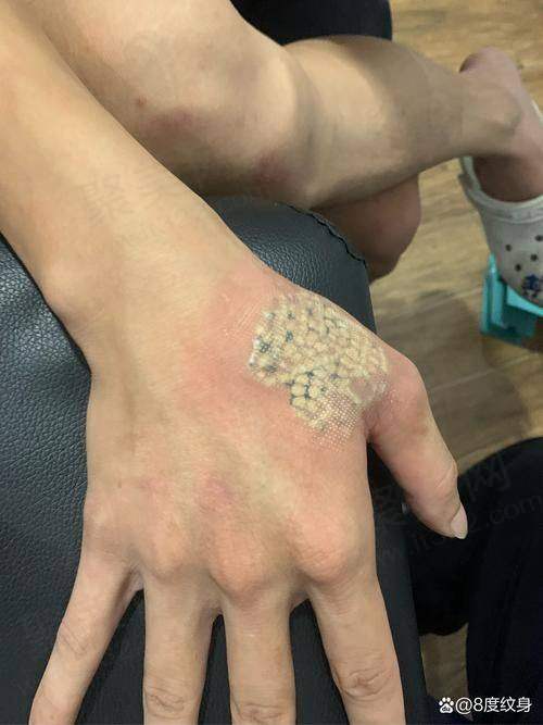 总结
