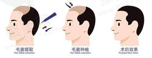 八、廊坊凯润婷医疗美容门诊部预约方式