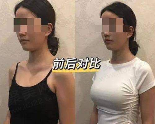 六、北京京城皮肤医院舒彬医生患者评价