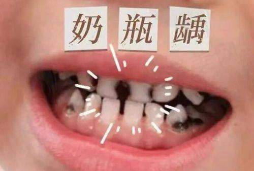五、厦门嚼力口腔霞阳门诊价格表：（仅供参考）