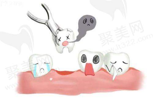 成都医大口腔医院的其他收费标准参考