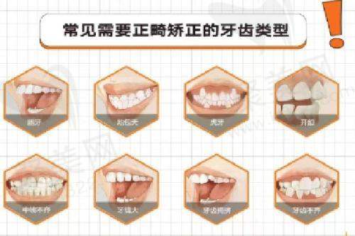 常州牙佳达口腔李世松医生牙齿矫正项目怎么样？