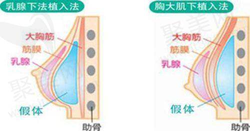 湛江韩美整形医院王仁斌医生经验多吗？