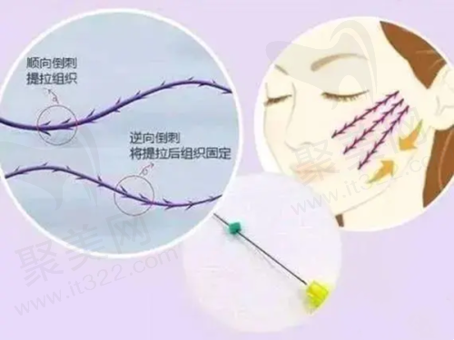 九、廊坊零皙医疗美容诊所真实的患者评价
