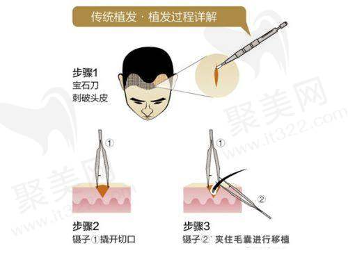 医生团队稳定，技术娴熟，服务细致