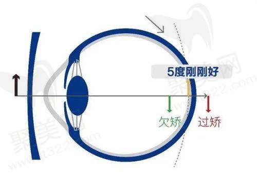 嘉兴爱尔眼科医院预约方式