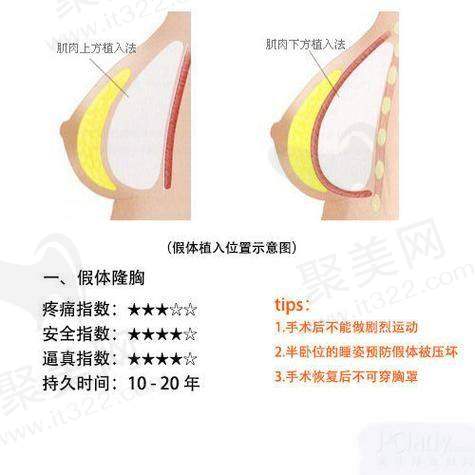 一、吴毅平医生怎么样：个人简介