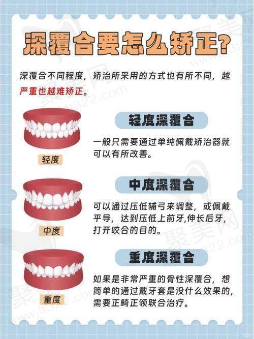 成都医大口腔医院深覆合隐适美智能矫正价格是多少呢？