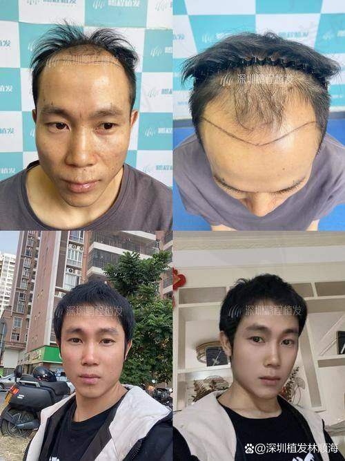 用户反馈佐证真实体验，成效口碑逐年累积