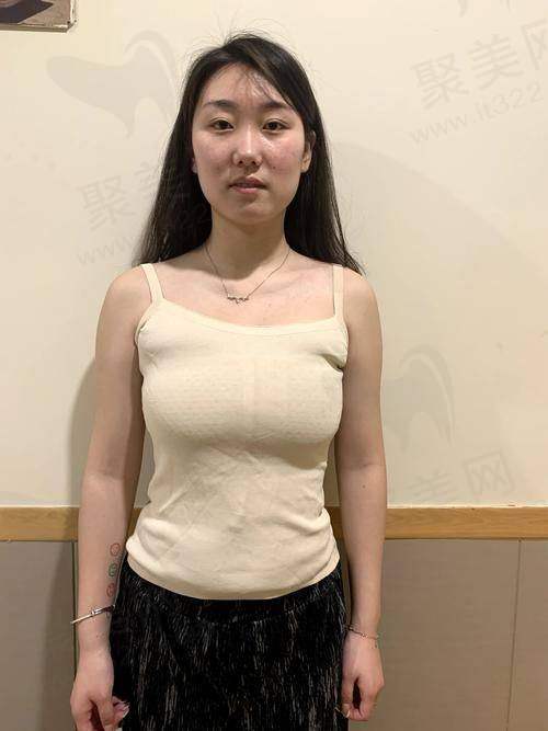 广西亚太医疗美容医院黎冻医生动冻波丰胸3.5W起，自然持久效果好，享个性化定制与优质服务