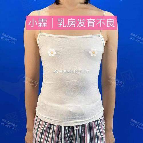 广西亚太医疗美容医院做动冻波丰胸的具体优势