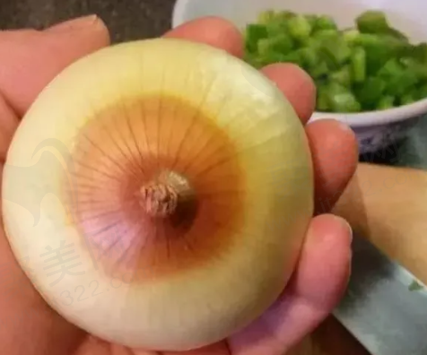 刘志刚眼修复成功实例