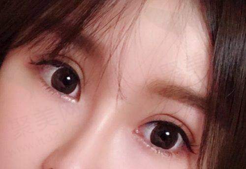 杭州美莱孟晨曦医生患者对其审美独特性评价怎么样？
