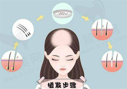 五、百年植发医院的特色项目