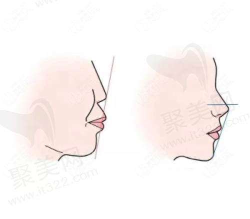 肇庆口腔医院排名前十新鲜出炉！国美、创齿等凭技术与服务成90%本地人优选 