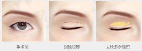 大连爱德丽格整形除皱:社会职责感提升口碑形象