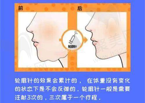 成功实例:见证美丽蜕变