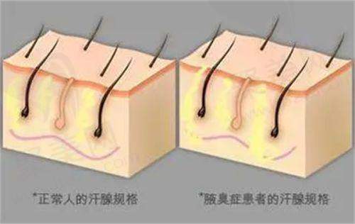 刘志刚眼修复预约方式