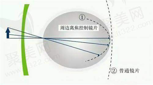 上海新视界眼科医院怎么样评价如何？连锁优势/医生强/患者好评证明实力不错