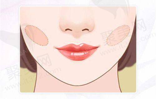 注射项目价格:20000元起的多元选择