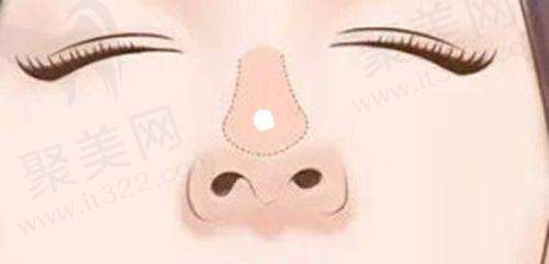 杨晓英医生:注射领域的专精能手