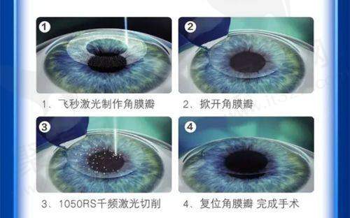 商业保险补充方案