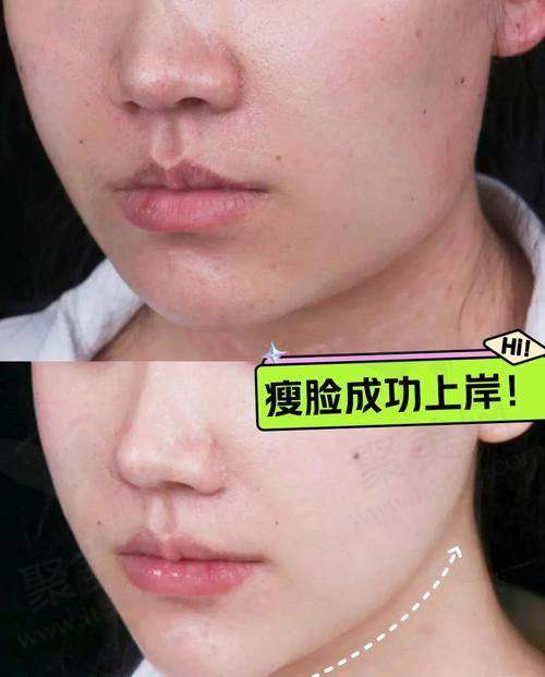 五、苏州工业园区艺德雅医疗美容诊所怎么预约：