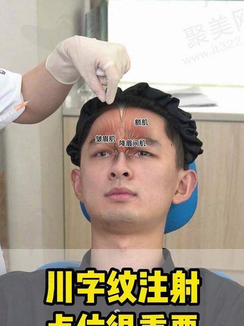 川字纹恒久消除价格与胶原蛋白填充的对比