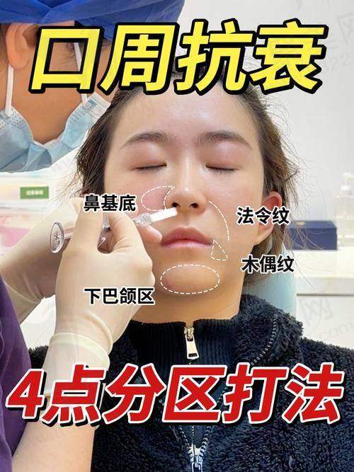 一、苏州工业园区艺德雅医疗美容诊所怎么样？