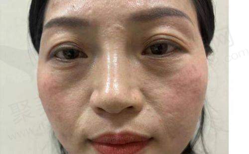 七、苏州工业园区艺德雅医疗美容诊所真实的患者评价如下：