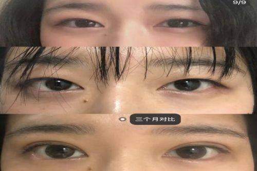 预约杭州孟晨曦医生需要注意什么？