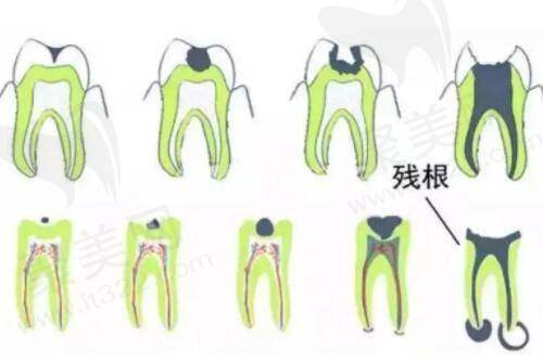 罗曼医师擅长项目