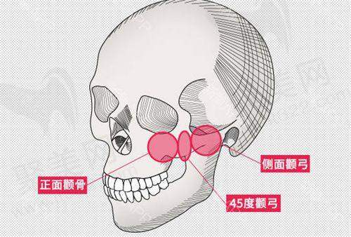 合肥华美整形外科医院张瑞鹏医生预约方式