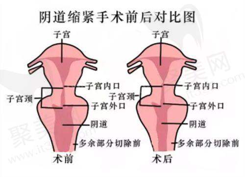 昆明杰西艾——依托国有医院技术背书
