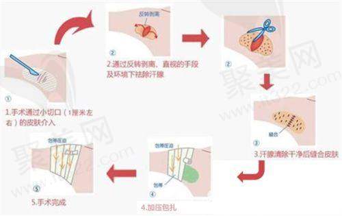 西安综合类三等甲医院做眼袋手术推荐