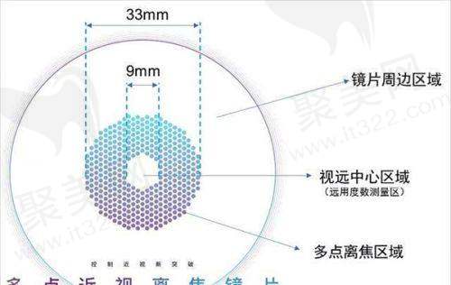如何选择适合自己的近视眼手术及医院