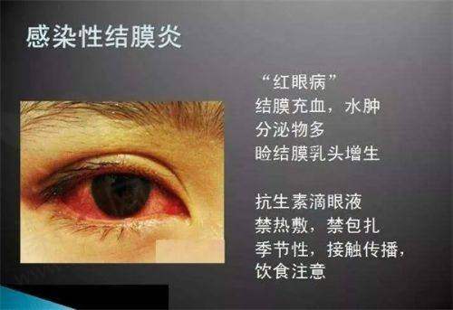 新疆维吾尔自治区人民医院眼科——综合实力强劲的老牌医院
