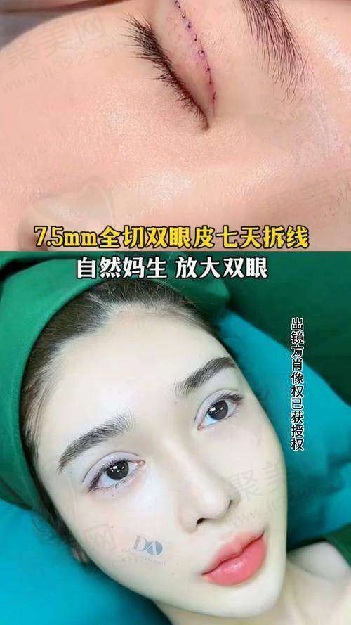 患者的真实口碑评价