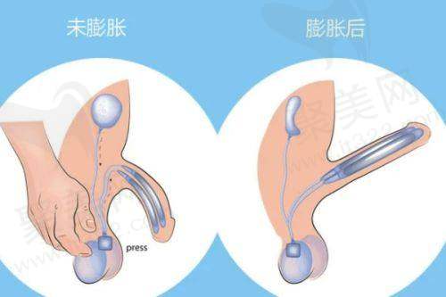 嘉兴韩辰医疗美容周小伟擅长项目