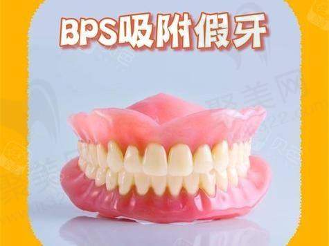 苏州美奥口腔做全口吸附性义齿有哪些优势？