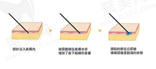 杭州冰美医疗美容门诊部怎么样？