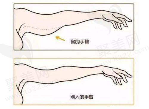 泰国咖蒙整形医院变性手术的优势总结