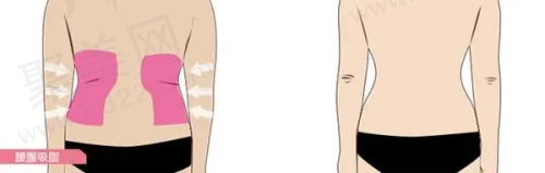 女变男手术情况