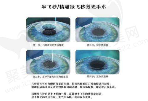 张家口四 医院眼科就诊注意事项
