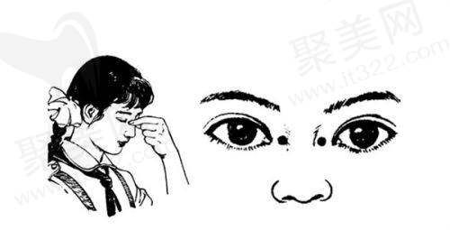60、70、80岁老人白内障手术补贴政策解读